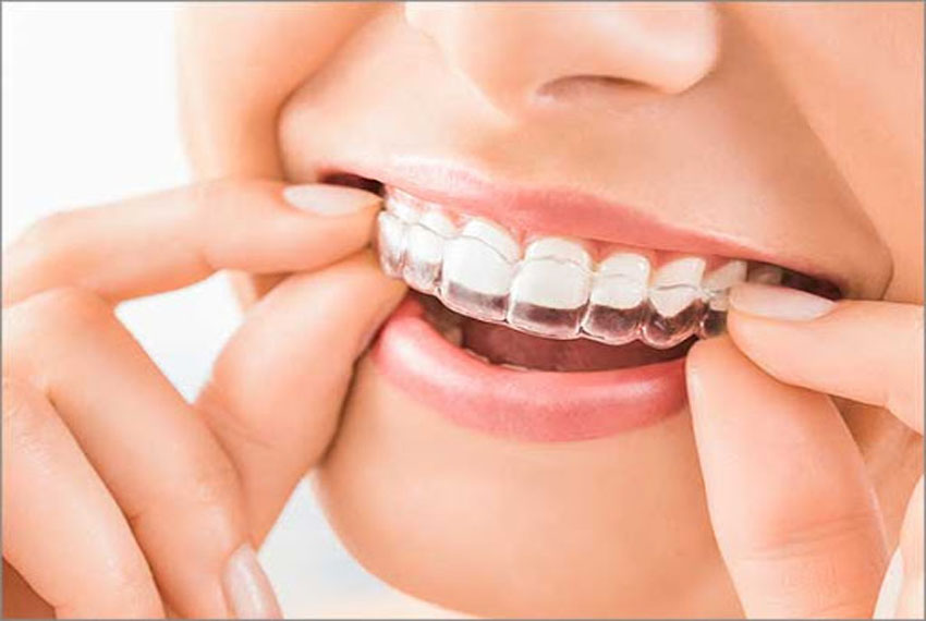 smile designing treatment in gandhinagar