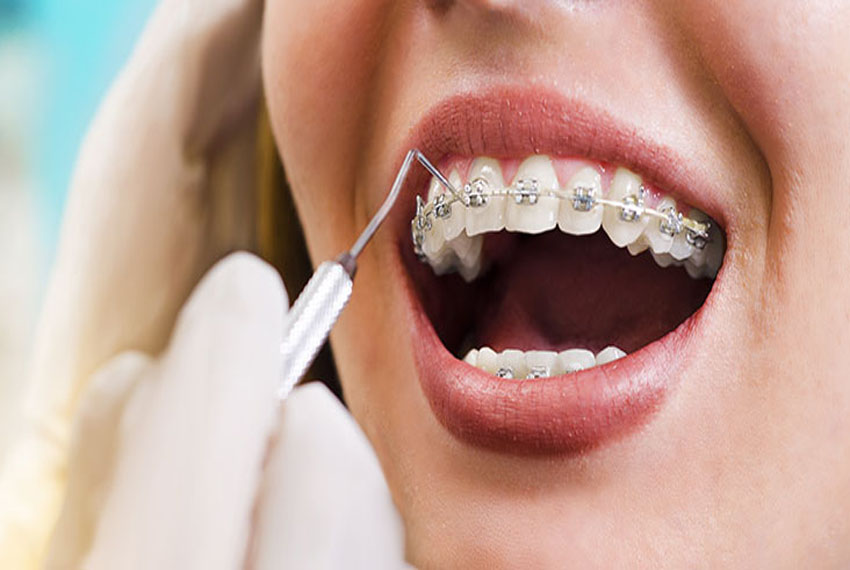 orthodontic services in gandhinagar