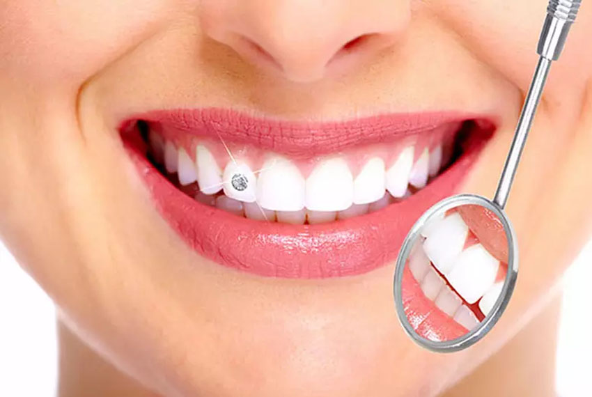 dental jewellery treatment in gandhinagar